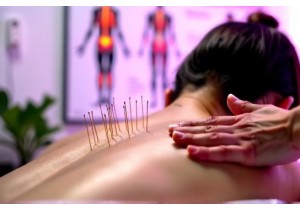 Does Acupuncture Treatment Really Work for Nerve Pain