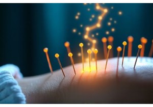 How Acupuncture Activates Endorphins for Pain Control