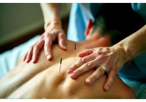Top Acupuncture Benefits Backed by Science and Clinical Studies