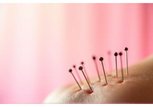 Ancient Chinese Medicine Principles Behind Modern Acupuncture Therapy