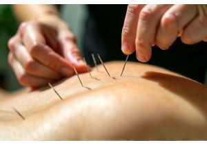 Enhancing Recovery with Post Injury Acupuncture Treatment Plans