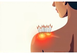 Acupuncture for Shoulder Pain Relief and Mobility Restoration
