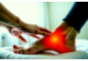 Treating Plantar Fasciitis with Tui Na and Stretching