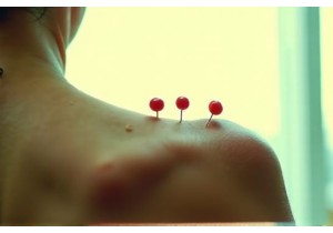 Cultural Adaptation of TCM in Western Countries