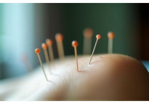 Drug-Free Healing with Traditional Acupuncture Techniques