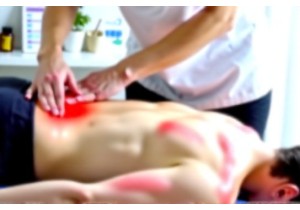 Sports Injury Rehabilitation Using Tui Na and Gua Sha