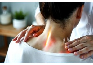 Treating Neck Pain with Acupuncture A Non Invasive Solution