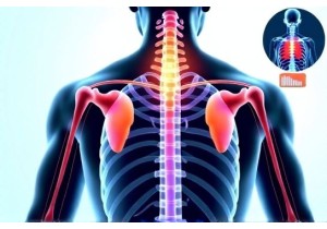 Cupping Therapy Enhances Lymphatic Drainage and Reduces Edema Naturally