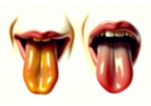 Identifying Damp Heat or Yin Deficiency Through Tongue Coating Clues