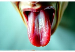 Tongue Image Analysis for Common Patterns Like Damp Heat ...